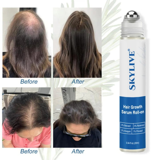 Sérum roll-on pour la croissance des cheveux